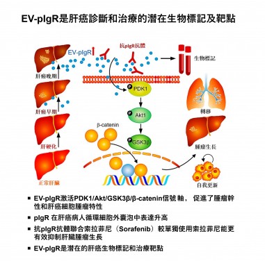 港大醫學院發現肝癌患者體內細胞外囊泡中的關鍵分子可作為肝癌早期診斷生物標記以及腫瘤治療靶點
 