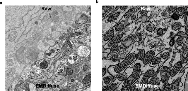 (a) EMDiffuse removes noise and restores ultrastructure information from noisy electron microscope images; (b) EMDiffuse enhances the axial resolution of volume electron microscope data. Image modified from Lu et al, Nature Communications (2024).